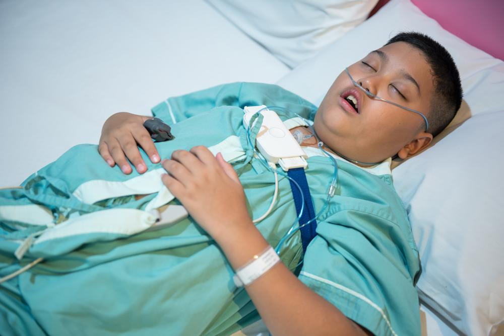 Sleep Apnea in Children